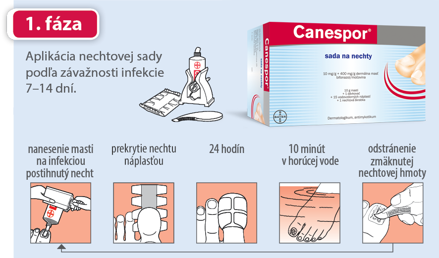 canespor - použitie sady na nechty